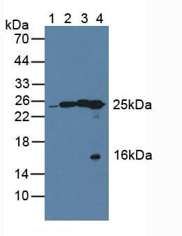 QDPR / DHPR Antibody (aa1-244, APC)