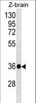 HOXD10 Antibody (aa305-334)