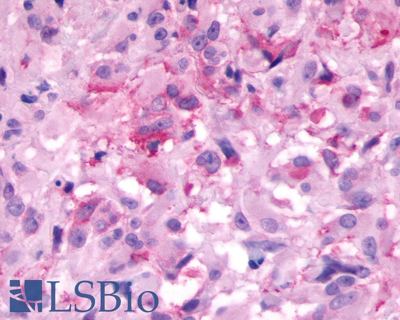 PathPlus™ NMBR Antibody (Cytoplasmic Domain)