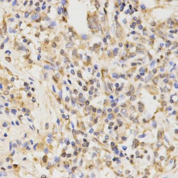 Polyclonal Rabbit anti-Human APG5 / ATG5 Antibody (IHC)