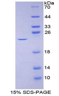 Mouse IL2 Protein (Recombinant His-T7)
