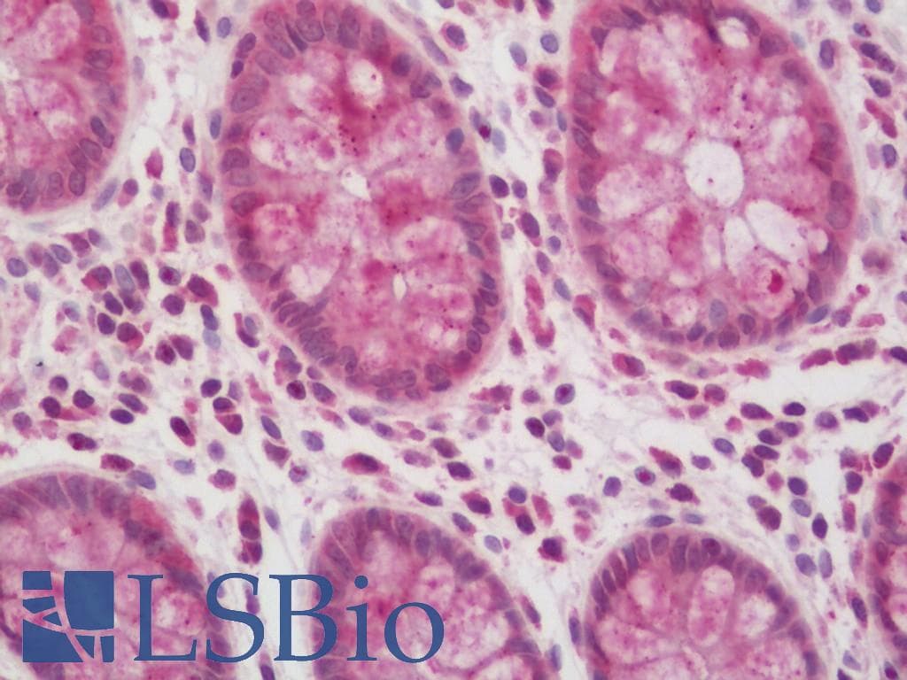 IHC-plus™ MRFAP1L1 Antibody