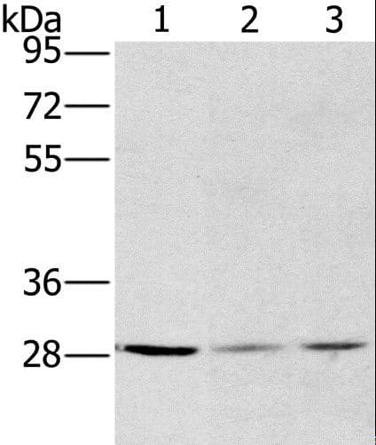 PathPlus™ HSD17B12 Antibody
