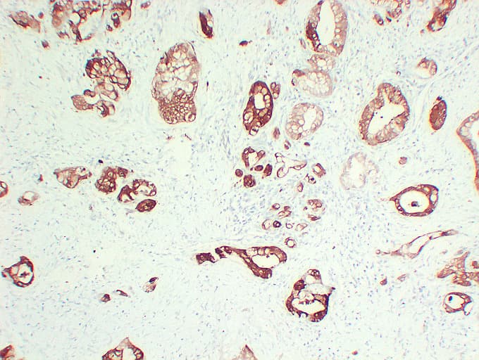 S100A6 / Calcyclin Antibody (clone ABT-S100A6)