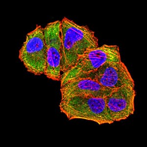 Monoclonal Mouse anti-Human c-Met Antibody (clone 5E9C4, IHC, IF, WB)