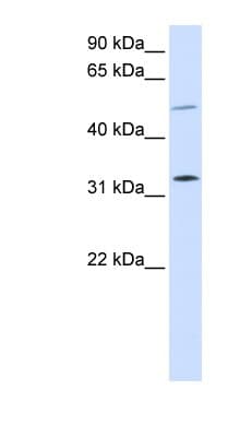 SHOX2 Antibody (aa108-157)