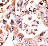Polyclonal Rabbit anti-Human DUSP3 / VHR Antibody (aa1-30, IHC, WB)