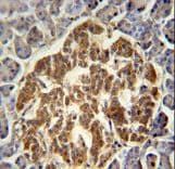 GTPCH1 / GCH1 Antibody (aa39-67)