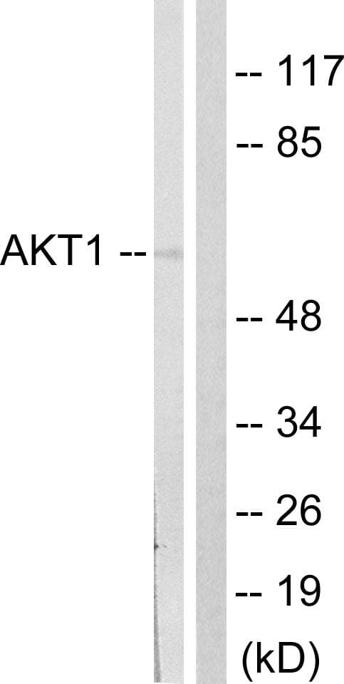 Polyclonal Rabbit anti-Human AKT1 Antibody (p124, WB)