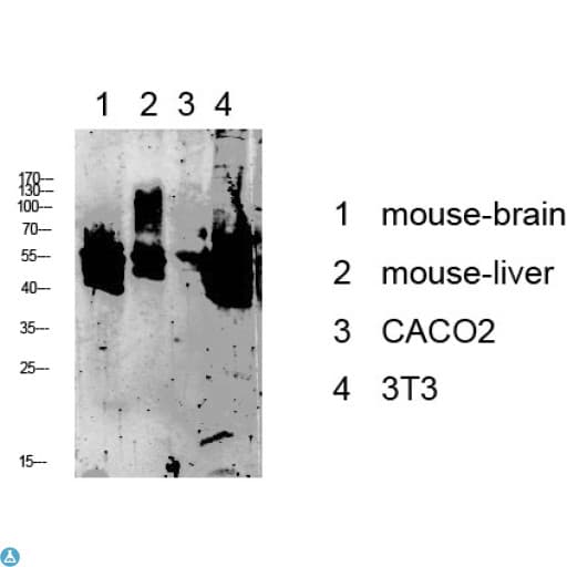 KRT8 / CK8 / Cytokeratin 8 Antibody