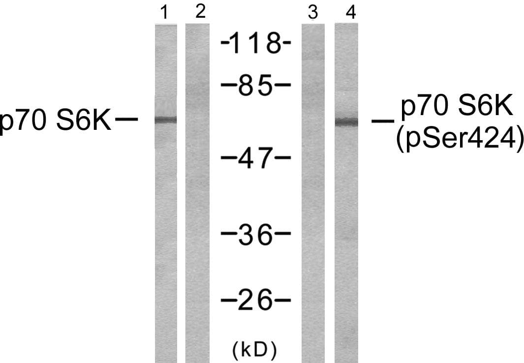 RPS6KB1 / P70S6K / S6K Antibody (phospho-Ser424)