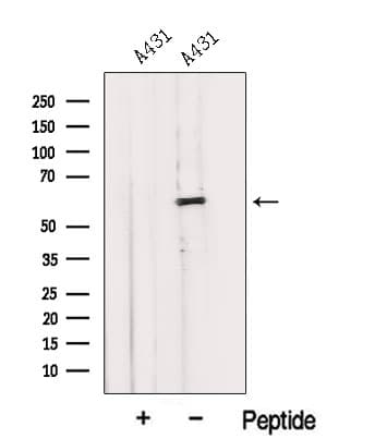 Polyclonal Rabbit anti-Human IMPDH1 Antibody (WB)