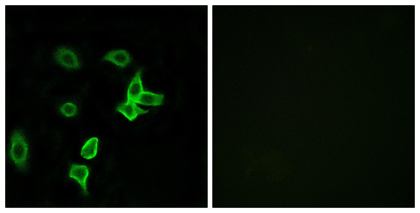 KANK2 Antibody
