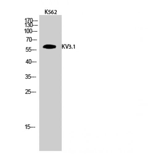 KCNC1 / Kv3.1 Antibody (190-270 aa, Internal)