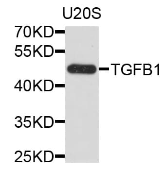TGFB1 / TGF Beta 1 Antibody