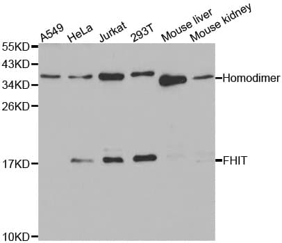 Polyclonal Rabbit anti-Human FHIT Antibody (IHC, WB)