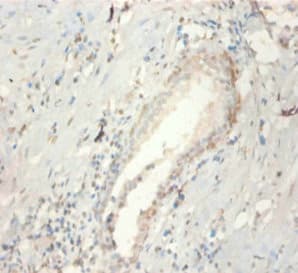FGF21 Antibody
