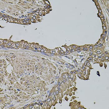 MAP1B Antibody