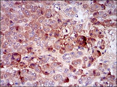 Monoclonal Mouse anti-Human CSF1R / CD115 / FMS Antibody (clone 6B9B9, aa344-497, IHC, IF, WB)