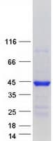 Human MAPRE2 / EB2 Protein (Recombinant Myc-DDK (Flag))