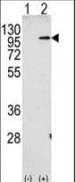 Polyclonal Rabbit anti-Human APP / Beta Amyloid Precursor Antibody (aa29-61, IHC, WB)