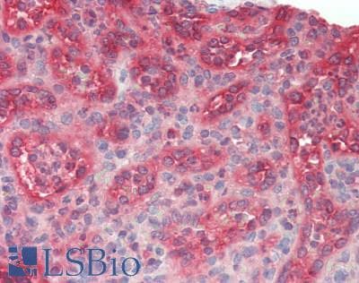 S100G / CABP9K Antibody