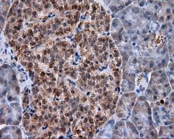 Monoclonal Mouse anti-Human HMRF1L / MTRF1L Antibody (clone OTI1H5, IHC, IF, WB)