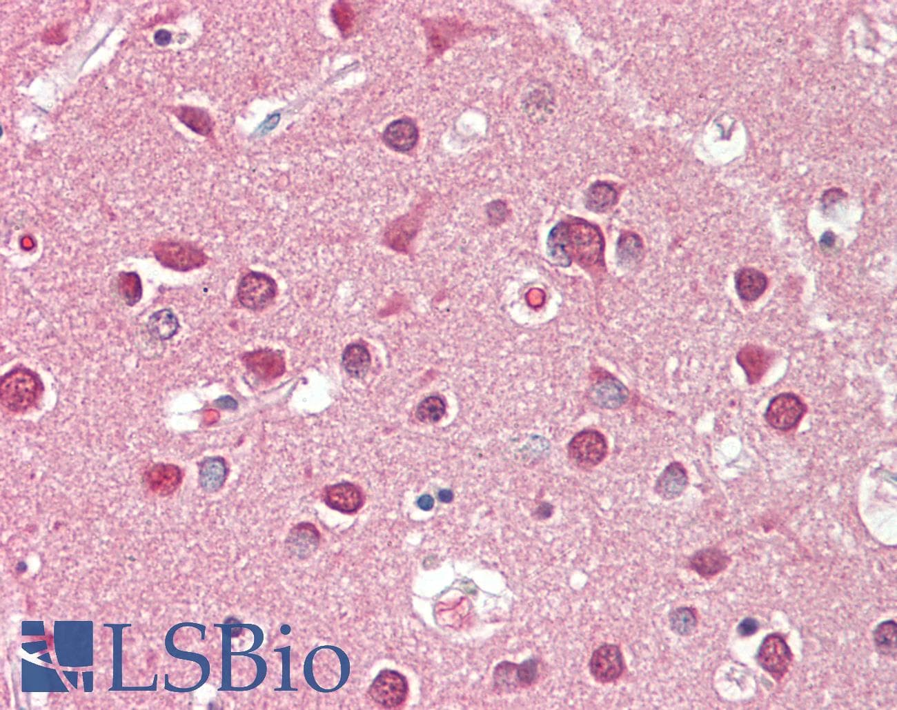 IHC-plus™ CST3 / Cystatin C Antibody (aa95-122)