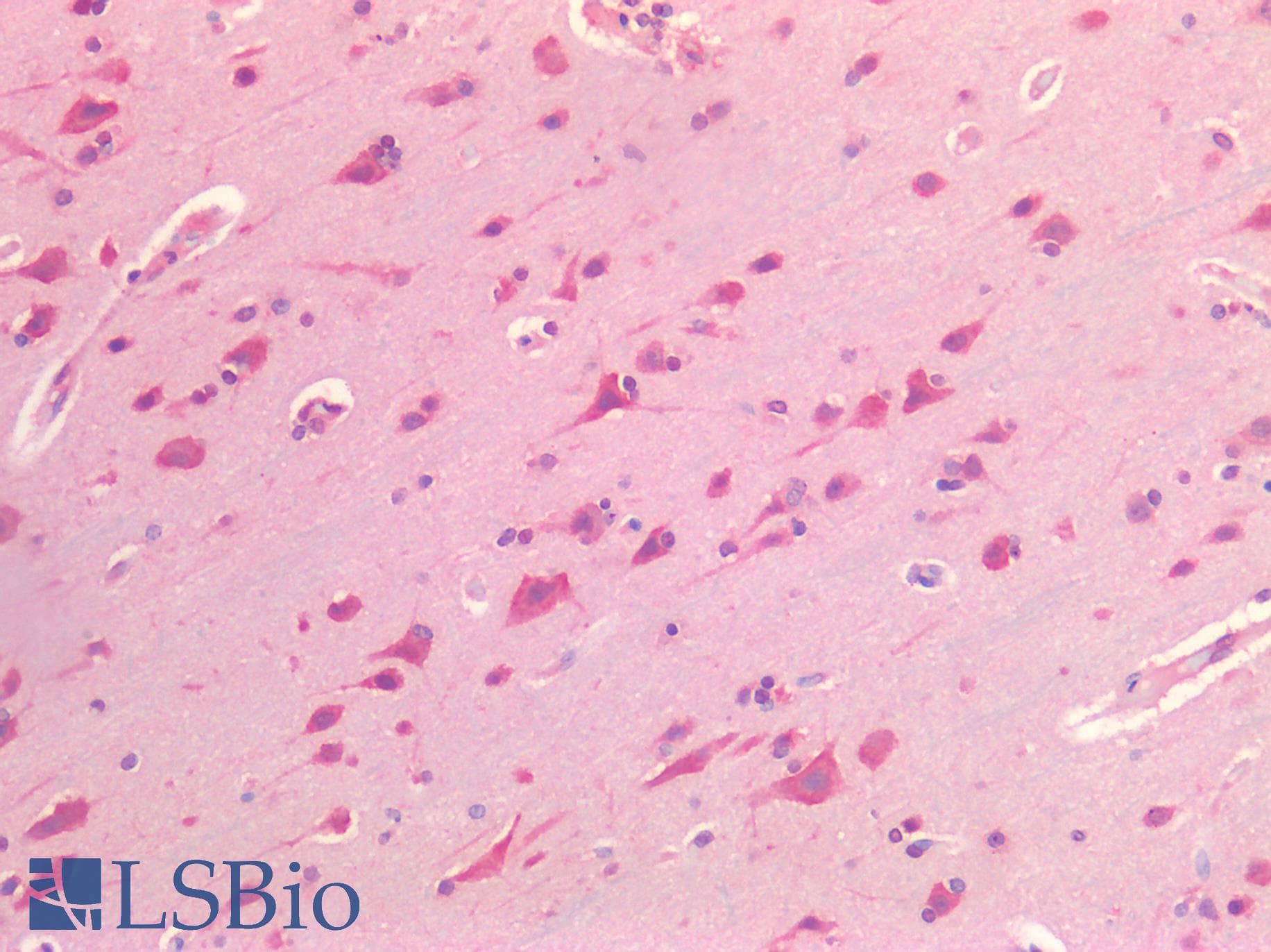 IHC-plus™ PDGFRA / PDGFR Alpha Antibody