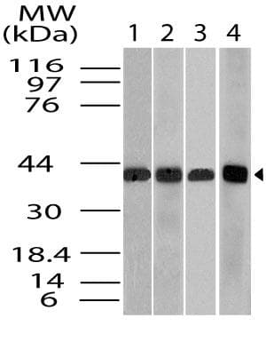 SMARCB1 / INI1 Antibody (aa1-200)