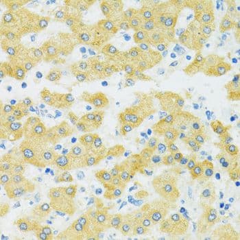 SLC37A4 / G6PT Antibody