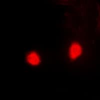 PSMD10 / Gankyrin Antibody