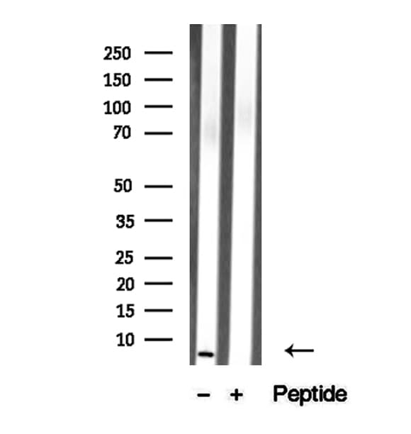 TMSB4X / Thymosin Beta-4 Antibody