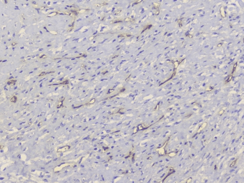 TEK / TIE2 Antibody