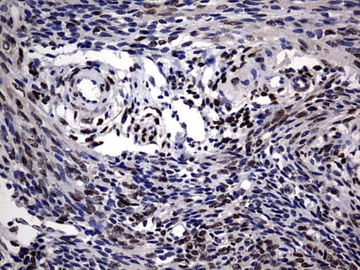 Monoclonal Mouse anti-Human PRX-1 / PRRX1 Antibody (clone OTI6A4, IHC, WB)