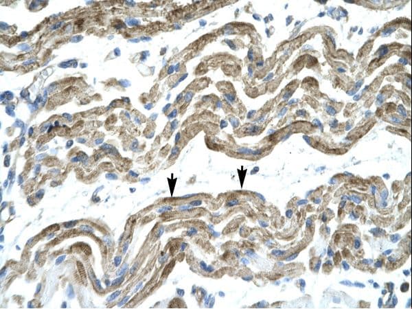 C13orf8 / ZNF828 Antibody (aa261-310)