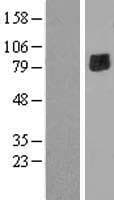 ENTPD7 Protein (Over-Expression Lysate Myc-DDK (Flag))