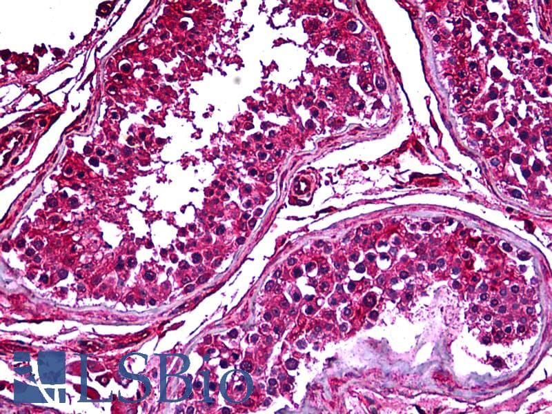 IHC-plus™ PDK2 Antibody (clone 2G1)
