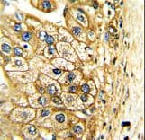 Polyclonal Rabbit anti-Human ALDH3A2 Antibody (IHC, WB)