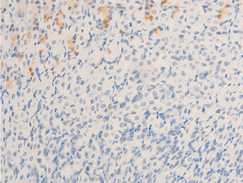 Polyclonal Rabbit anti-Human MITF Antibody (phospho-Ser180,phospho-Ser73, IHC, IF, WB)
