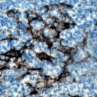 ZAP70 Antibody (phospho-Tyr319)