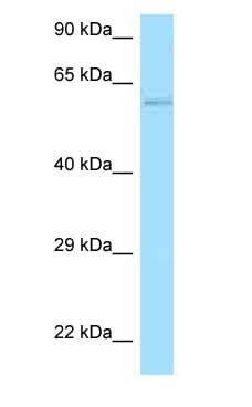 Polyclonal Rabbit anti-Human FAM190B Antibody (aa670-719, WB)