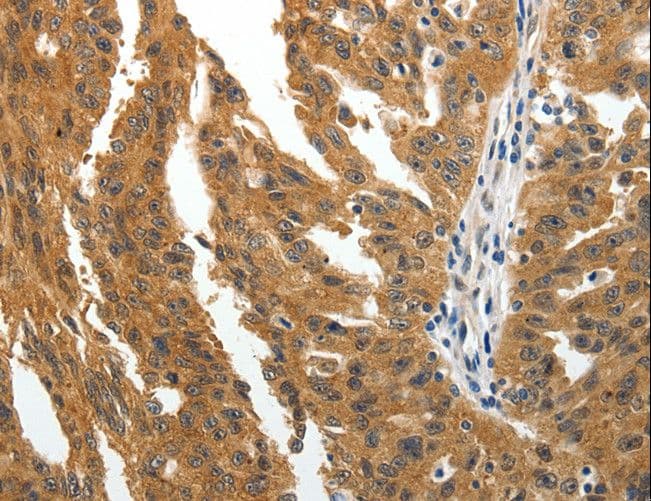 BRUCE / BIRC6 Antibody