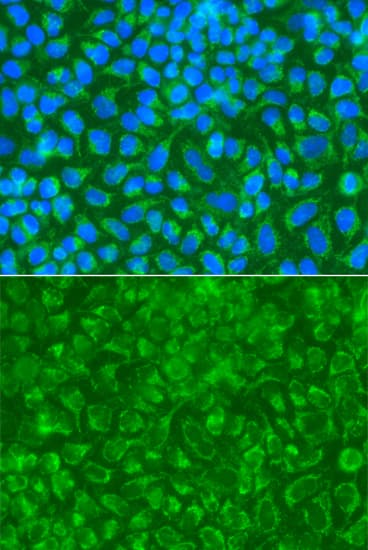 STRN / Striatin Antibody
