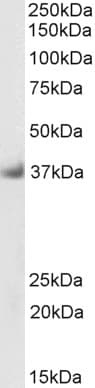 SGCD / Delta-Sarcoglycan Antibody (aa245-257, Biotin)