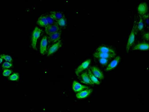 IHC-plus™ NRAS / N-ras Antibody