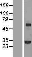 TGM2 / Transglutaminase 2 Protein (Over-Expression Lysate Myc-DDK (Flag))