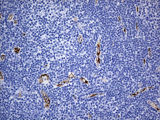 Monoclonal Mouse anti-Human CD34 Antibody (clone OTI8F11, aa312-385, IHC, WB)