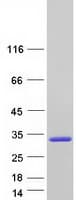 Human NAT15 Protein (Recombinant Myc-DDK (Flag))