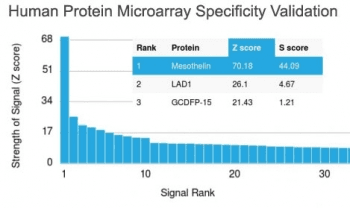 Monoclonal Mouse anti-Human MSLN / Mesothelin Antibody (clone MSLN/2131, IHC)